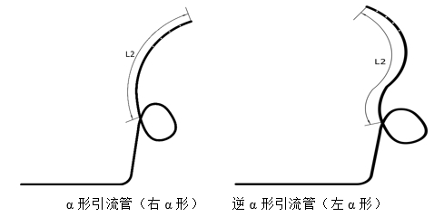 經(jīng)鼻膽汁外引流管注冊審查指導(dǎo)原則（2022年第41號）(圖13)