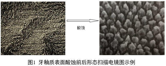 牙科用磷酸酸蝕劑注冊審查指導原則（2022年第41號）(圖1)